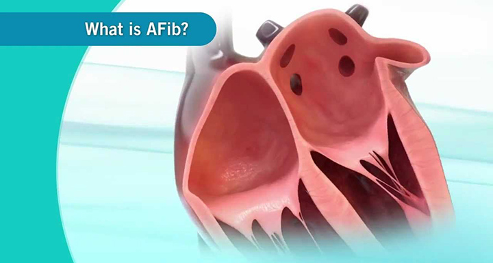 a-fib, blood thinners, stroke, afib