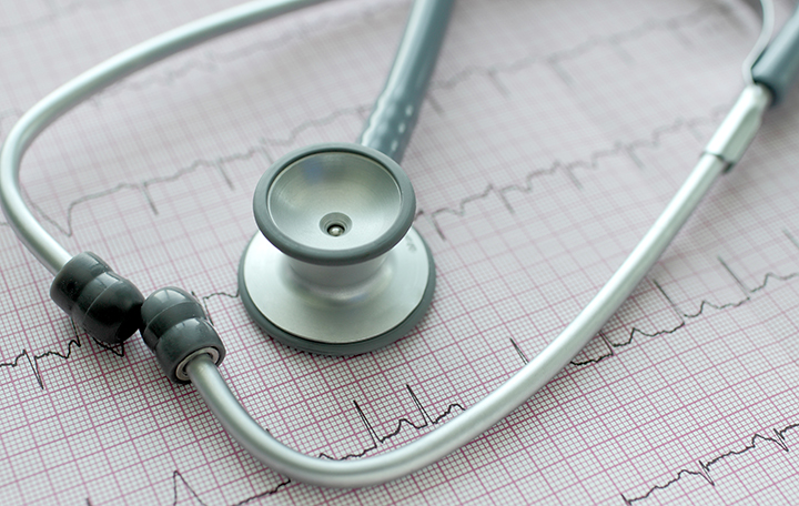 afib, atrial fibrillation, afib treatment