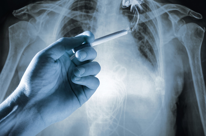 type 2 diabetes, diabetic, smoking and diabetes