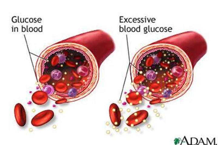 coffee and diabetes, type 2 diabetes, blood glucose levels, diabetes diet