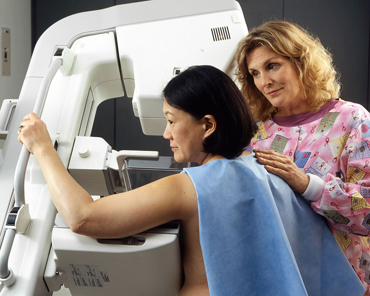 invasive lobular carcinoma, breast cancer, breast cancer treatment