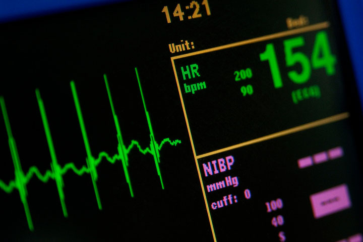 dabigatran, afib, blood thinners, anticoagulants