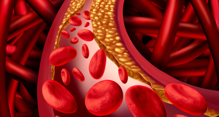 dabigatran, afib, blood thinners, anticoagulants