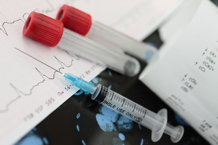 warfarin, afib, blood thinners, anticoagulants