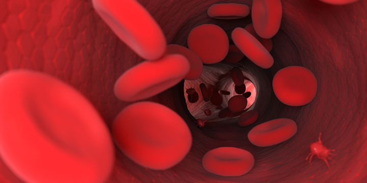 afib, stroke, stroke prevention