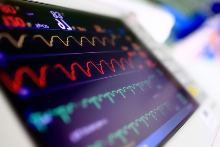 what is AFib, AFib, atrial fibrillation