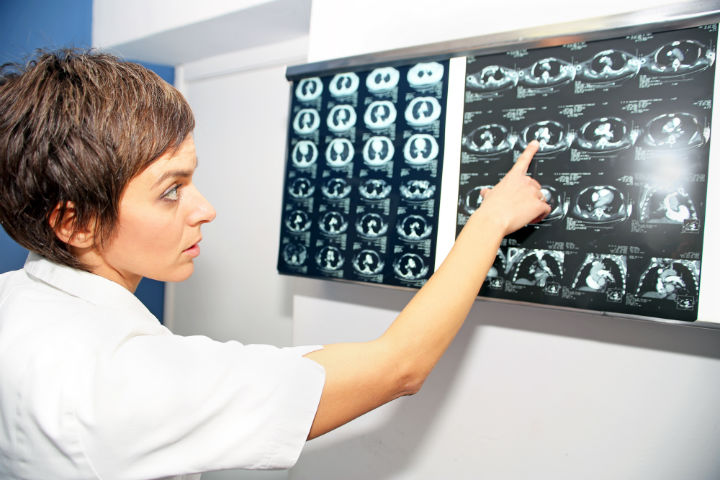 treatment pulmonary embolism, pulmonary embolism treatment, pulmonary embolism treatments, treatments for pulmonary embolism, treatment for pulmonary embolism, pulmonary embolism info