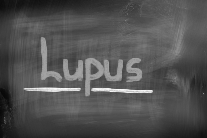 Lupus Symptoms