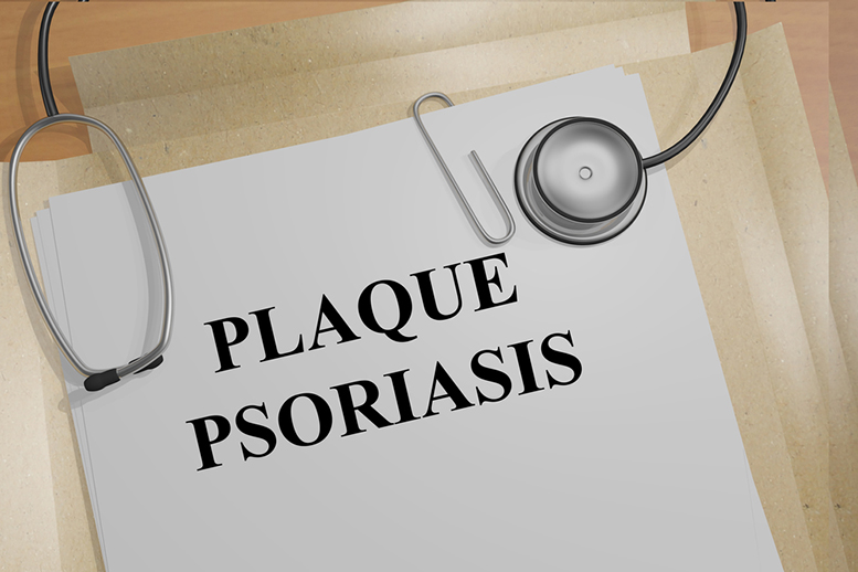 Ixekizumab Plaque Psoriasis Treatment