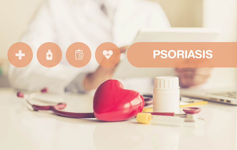 Plaque Psoriasis Treatment