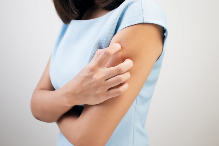 Dupixent Eczema Treatment