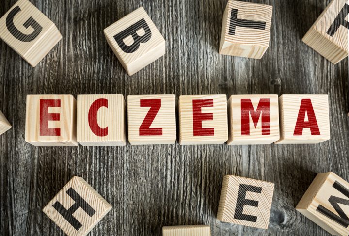 Atopic Eczema Relief